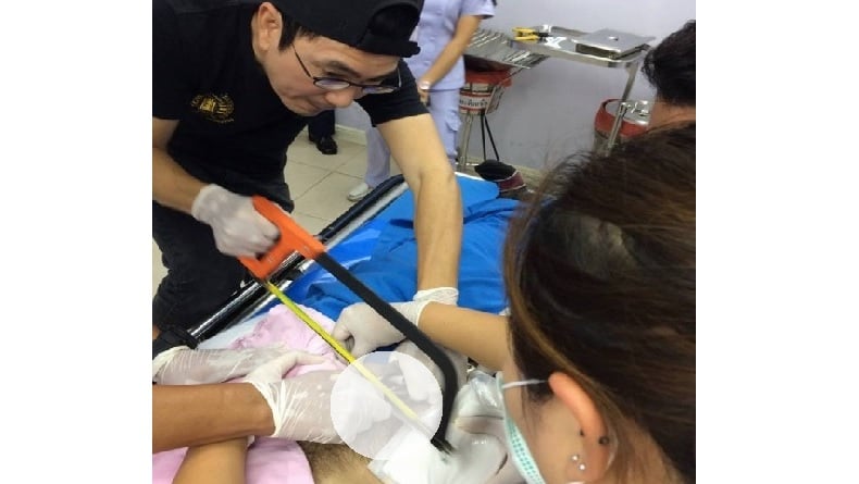 Pria Ini Ikut Prosedur Pembesaran Penis lalu Cek Hasilnya ke Pipa Plastik, Akibatnya Fatal