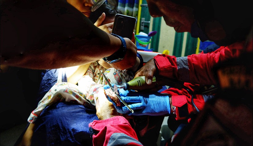 Bikin Ngilu, Begini Momen Damkar Potong Cincin yang Tersangkut di Jari Anak Kecil - Bagian 2