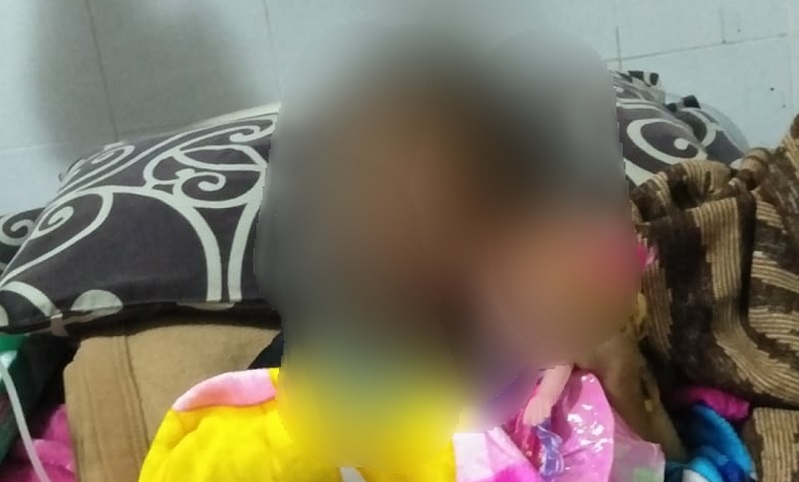 Balita di Batu Disiksa Calon Ayah Tiri, Kulit Melepuh karena Rokok dan Air Panas 