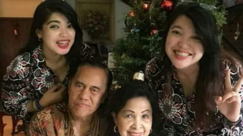 Kisah Profesor Padmo Melawan Takdir, Sempat Diragukan saat Selamatkan Bayi Kembar Siam