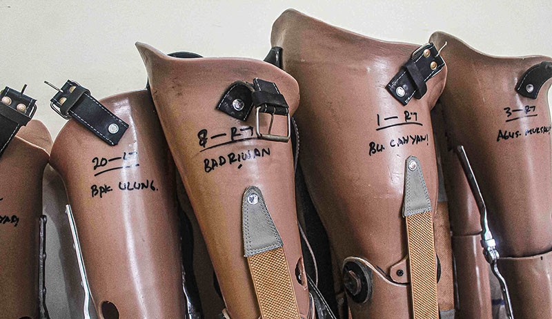 MNC Peduli-YEMI Kolaborasi Berikan Kaki Palsu untuk Penyandang Tunadaksa - Bagian 4