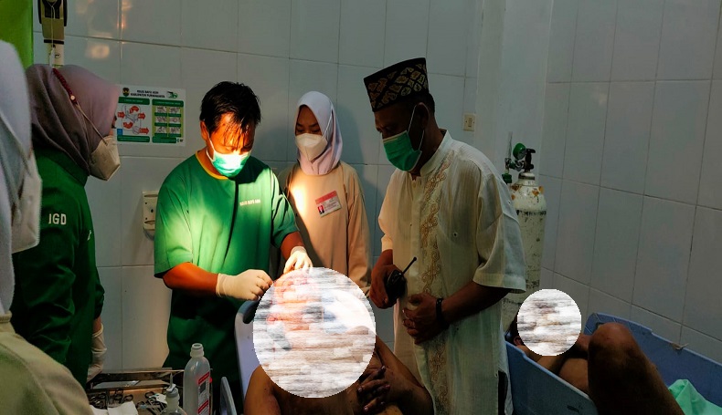 Gagal Curi Motor, 2 Pelaku Dipukuli Warga Purwakarta hingga Berdarah-darah