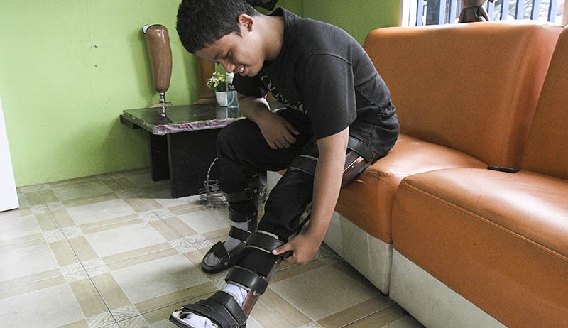 Pembuatan Kaki Palsu di Bekasi, Dijual hingga Puluhan Juta Rupiah - Bagian 3