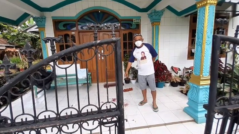 Tragis, Pengantin Baru yang Disiram Suami dengan Air Keras di Cianjur Meninggal