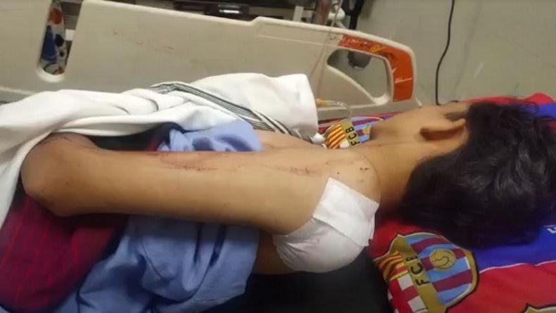 Pulang dari Kuburan 3 Remaja di Medan Dibacok Pria Berambut Pirang, 2 Luka Berat