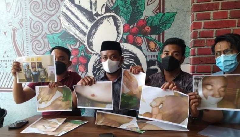 Dijemput Polisi untuk Pengembangan Kasus, Tahanan Lapas Bolangi Meninggal Tak Wajar