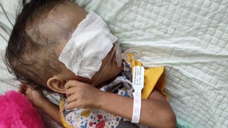 title Tolong... Balita 2 Tahun Penderita Tumor Mata di Way Kanan Butuh Bantuan Donatur Tolong... Balita 2 Tahun Penderita Tumor Mata di Way Kanan Butuh Bantuan Donatur