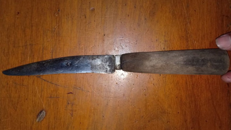 Minta Jatah Bercinta, Istri Ini Malah Potong Kelamin Suami lalu Coba Bunuh Diri