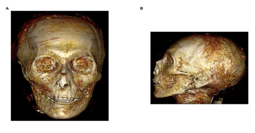 Peneliti Gunakan CT Scan untuk Buka Mumi Amenhotep I, Secara Fisik Mirip sang Ayah