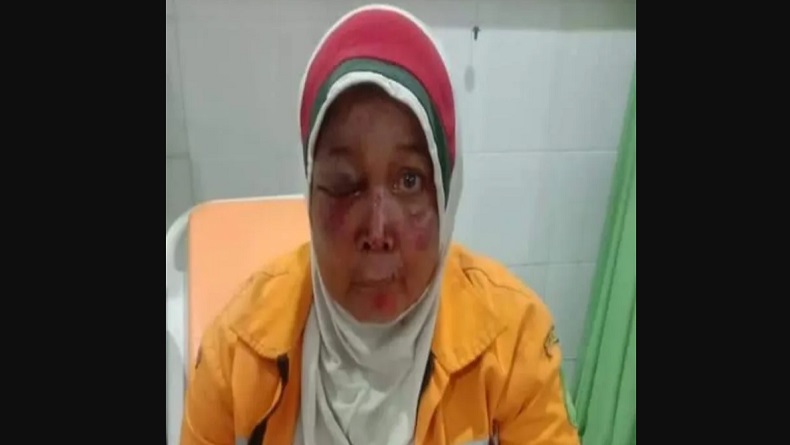 Petugas Kebersihan di Medan jadi Korban Begal