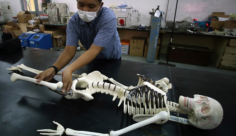 Produk Implan Ini sebagai Alat Pengganti Sendi Korban Patah Tulang Panggul - Bagian 2