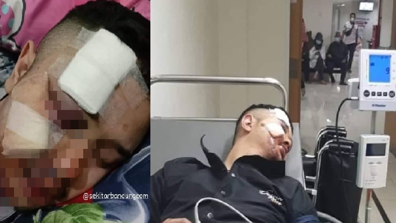 Bandung Rawan Aksi Begal, Penjahat Jalanan Pukuli Korban dan Gasak Motor Klasik