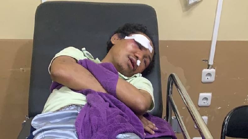 title Kasihan, Gegara Diduga Curi Makanan di Pasar, ODGJ Babak Belur Dihajar 3 Satpam Kasihan, Gegara Diduga Curi Makanan di Pasar, ODGJ Babak Belur Dihajar 3 Satpam