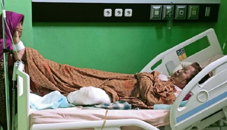 Istri Dibakar Suami Luka Bakar 50 Persen, Besok Operasi