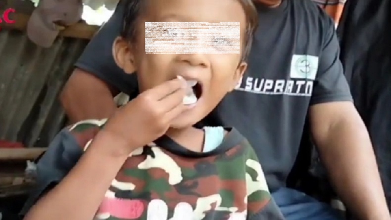 title Bocah di Cianjur Ngemil Papir Satu Pak per Hari selama 5 Tahun Bocah di Cianjur Ngemil Papir Satu Pak per Hari selama 5 Tahun