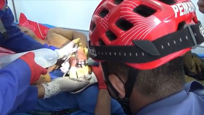 title Evakuasi Cincin di Jari Tangan Korban Pengeroyokan Berlangsung Dramatis, Terpaksa Dibius  Evakuasi Cincin di Jari Tangan Korban Pengeroyokan Berlangsung Dramatis, Terpaksa Dibius