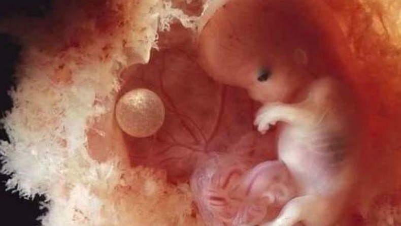 title Wow, Ilmuwan China Kembangkan Kecerdasan Artifisial terkait Janin di Rahim Buatan Wow, Ilmuwan China Kembangkan Kecerdasan Artifisial terkait Janin di Rahim Buatan