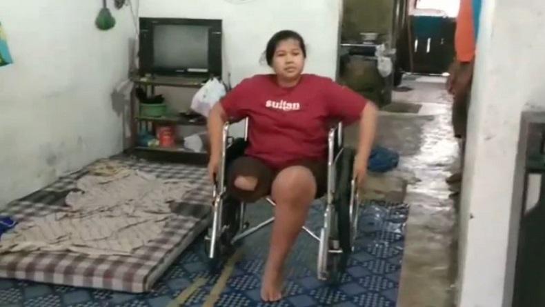 title Miris, Perempuan Disabilitas di Brebes Ini Derita Tumor Ganas pada Lutut Kaki Miris, Perempuan Disabilitas di Brebes Ini Derita Tumor Ganas pada Lutut Kaki