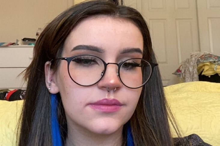  Punya Penyakit Langka, Mahasiswi Cantik Ini Kesakitan jika Terkena Sperma 