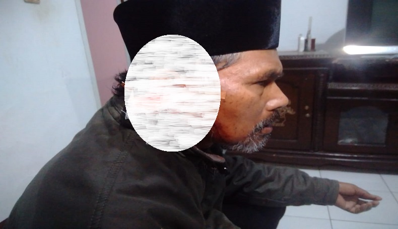 Sukabumi Heboh, Muazin Diserang OTK saat Sholat Subuh, Korban Luka Parah