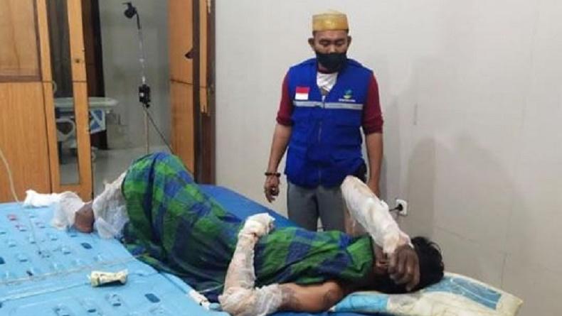 Aksi Nekat Pria di Gowa Bakar Diri gegara Kalah hingga Kehabisan Chip Higgs Domino