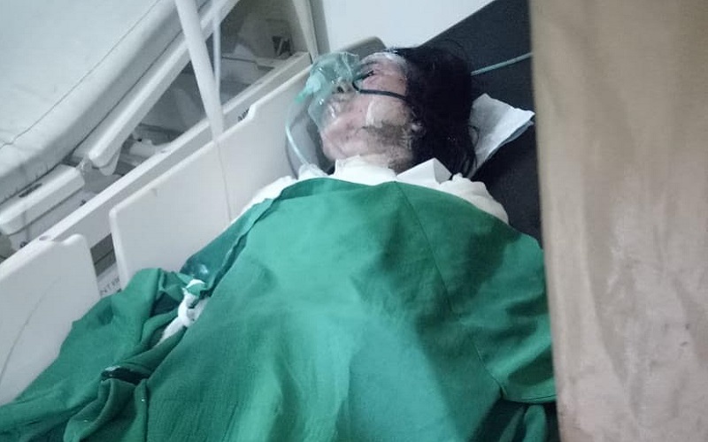 Sadis, Oknum Polisi Bakar Mantan Pacar karena Tidak Terima Diputus