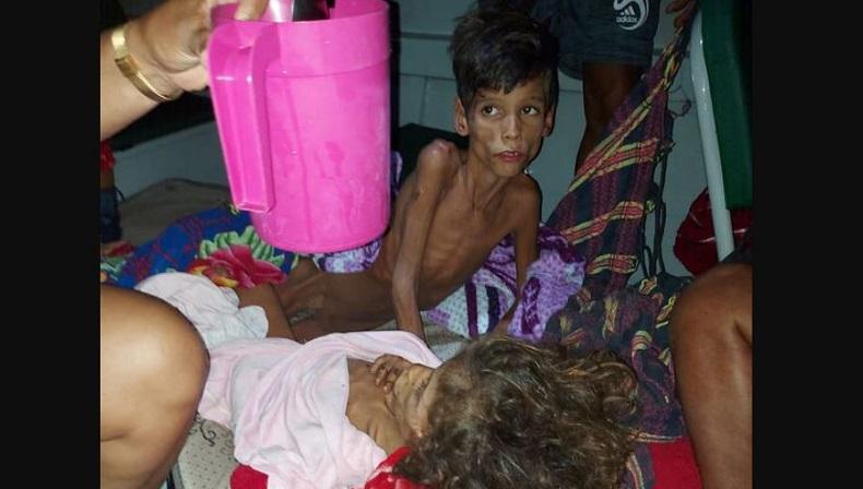 Kakak Adik Ditemukan Kurus dan Malnutrisi setelah Hilang 27 Hari di Hutan Amazon