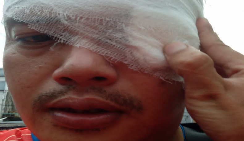 Wartawan TV Dihajar Oknum Polisi di Sumedang, IJTI Desak Kapolda Jabar Turun Tangan 