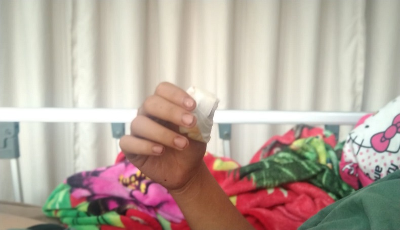 Dibacok Orang Tak Dikenal, Pemuda di Majalengka Hilang Ibu Jari