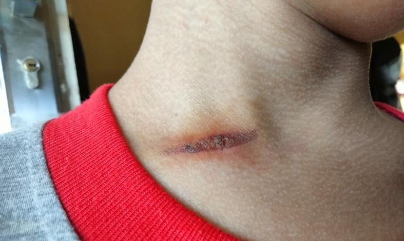 title  Kejamnya Ayah Tiri, Siksa Bocah 8 Tahun dengan Diikat dan Disetrika    Kejamnya Ayah Tiri, Siksa Bocah 8 Tahun dengan Diikat dan Disetrika