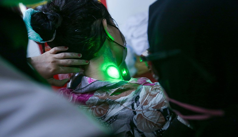 Layanan Hapus Tato Gratis di Jakarta Selatan - Bagian 4
