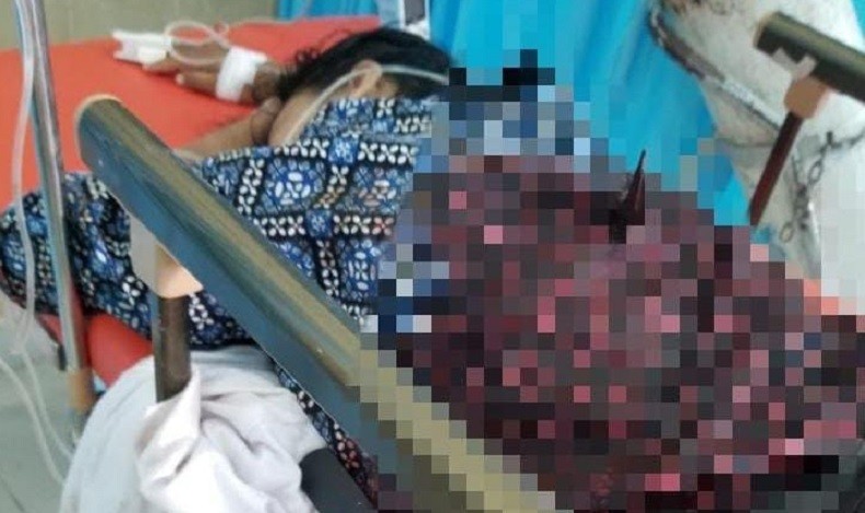 Siti Badriah Dibegal saat Berkendara, Senjata Tajam Masih Menancap di Punggung