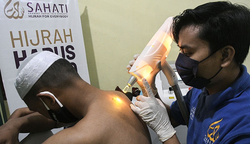 Layanan Hapus Tato Gratis di Bekasi hingga 25 April - Bagian 2