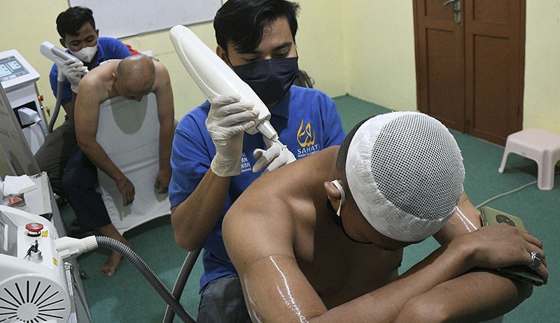 Layanan Hapus Tato Gratis di Bekasi hingga 25 April - Bagian 3