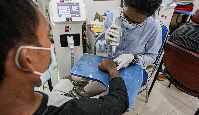 Banyak Warga Ingin Hijrah hingga Ikuti Layanan Hapus Tato Gratis - Bagian 3