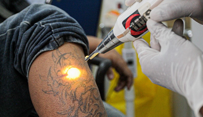 Banyak Warga Ingin Hijrah hingga Ikuti Layanan Hapus Tato Gratis - Bagian 5