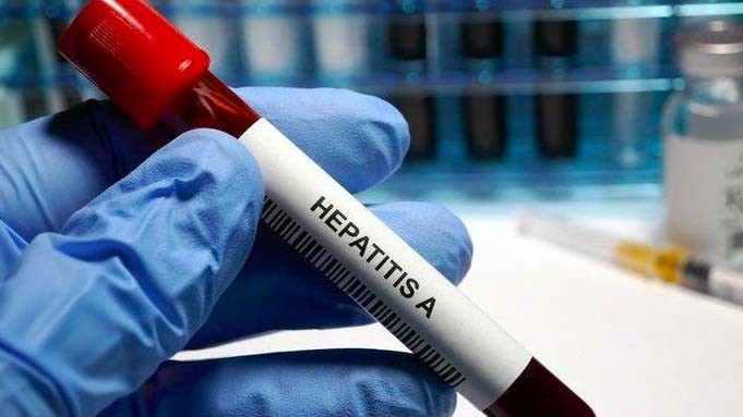  Waspadai Hepatitis Akut, Jika Alami Gejala Ini Segera ke Fasyankes Terdekat