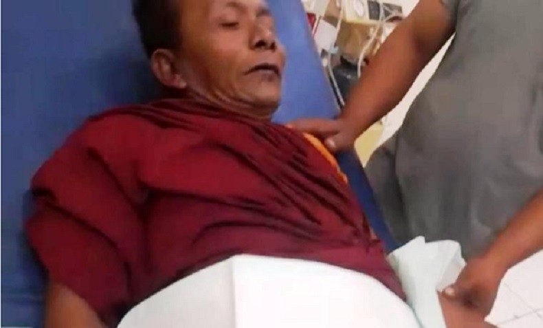 Petasan Meledak di Tangan, Warga Aceh Terluka Parah Dibawa ke Rumah Sakit