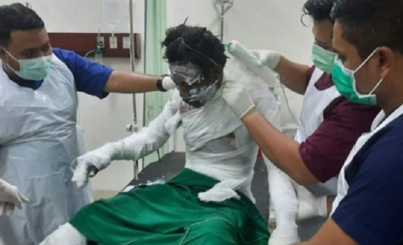Gerobak Bakso di Aceh Timur Terbakar, 9 Orang Luka Bakar Dirawat di Rumah Sakit