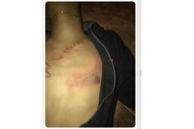 Pulang Nonton Voli, 2 Remaja di Gunungkidul Kena Sabetan Gir 