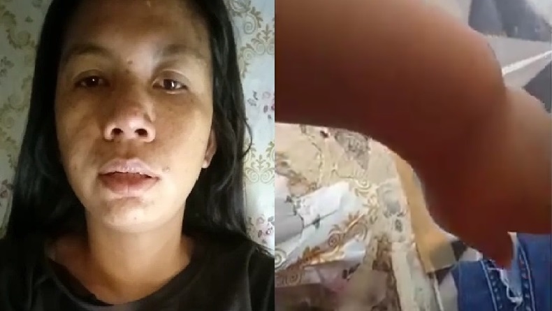 Tangan TKW asal Indramayu Patah di Dubai UEA, Kirim Video Minta Tolong ke Bupati Nina