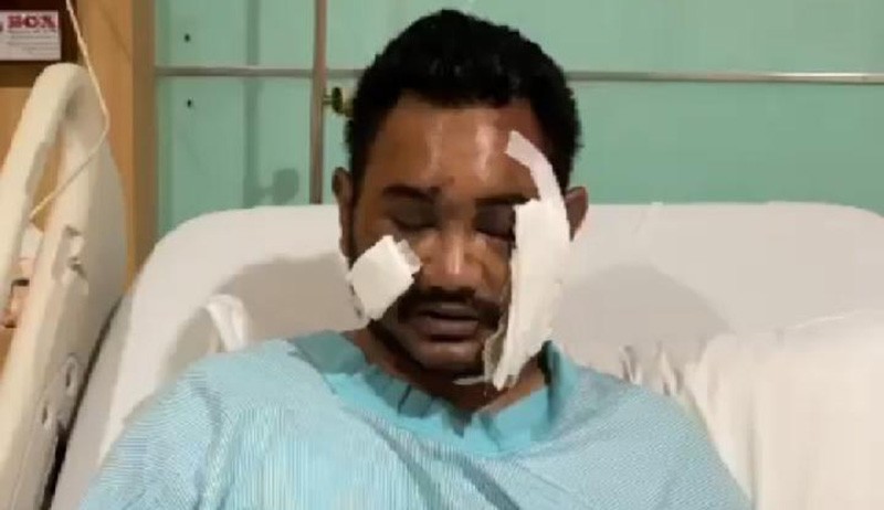 Korban Penganiayaan di Holywings Sleman Tuntut Keadilan, Polda DIY Turun Tangan - Bagian 1