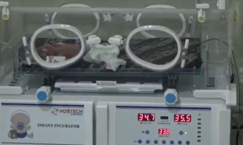 Ibu di Kolaka Timur Lahirkan Bayi Kembar 4 di Konawe, Semuanya Perempuan  