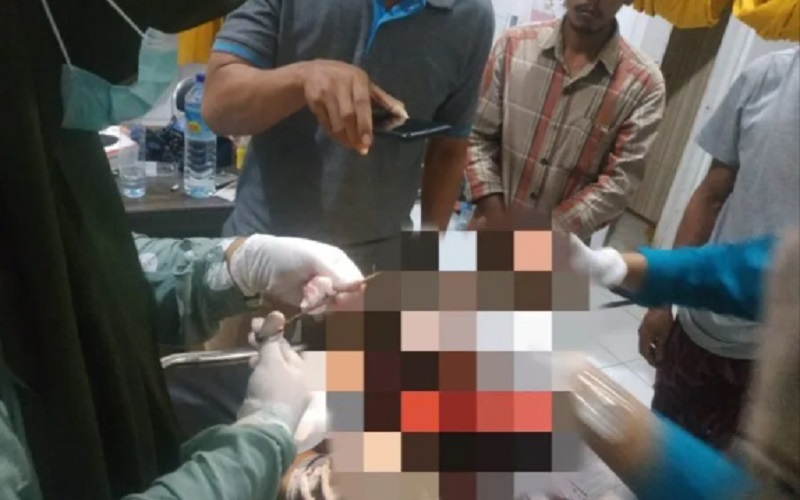 Terbakar Cemburu, Pria Ini Tebas Pacar Mantan Istri Pakai Parang