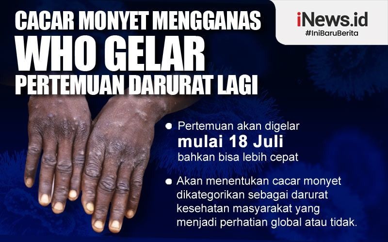 Cegah Cacar Monyet, Pintu Masuk Jawa Barat Dijaga Ketat, Penumpang Pesawat Diperiksa