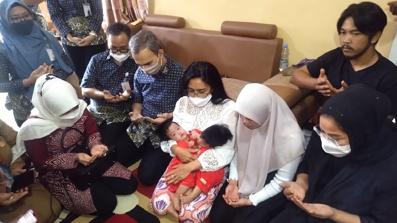 Kembar Siam Ayesta dan Aleeya Warga Cisarua KBB Segera Dioperasi di RSHS Bandung
