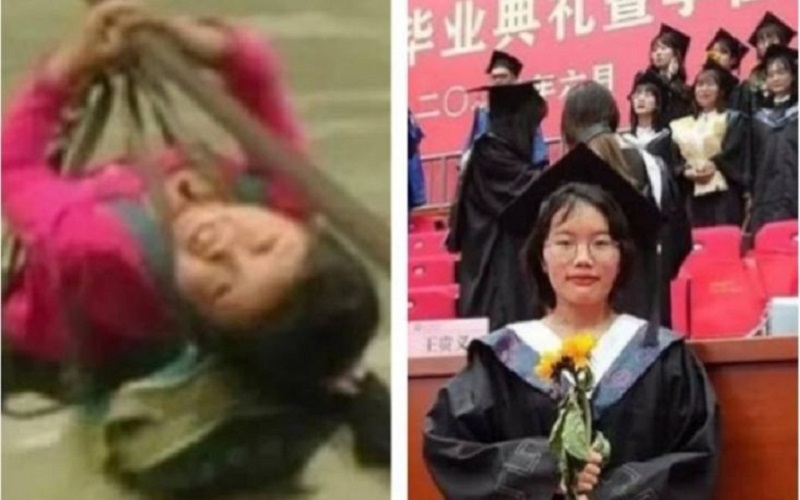 Hebat, Anak Sekolah yang Dulu Bertaruh Nyawa Seberangi Sungai Berhasil Jadi Dokter 