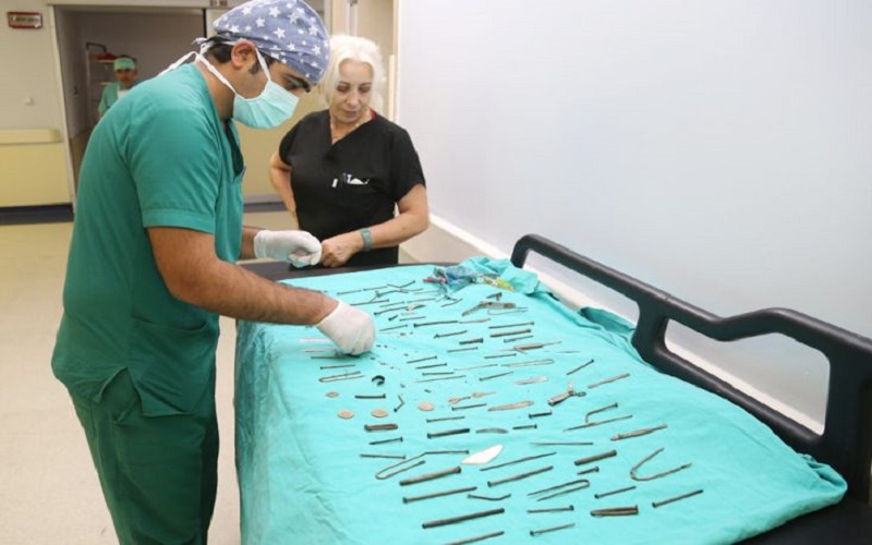 Perut Perempuan Ini Dipenuhi Gunting hingga Jarum, Dokter Sampai Syok saat Operasi