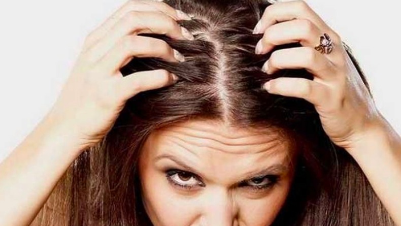 Atasi Ketombe di Rambut Kepala, 3 Cara Berikut Bisa Dicoba