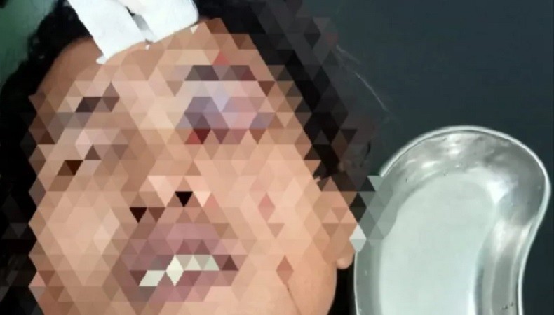 Pria Mabuk di Rohil Tusuk Mata Teman Usai Bertengkar di Kedai Miras